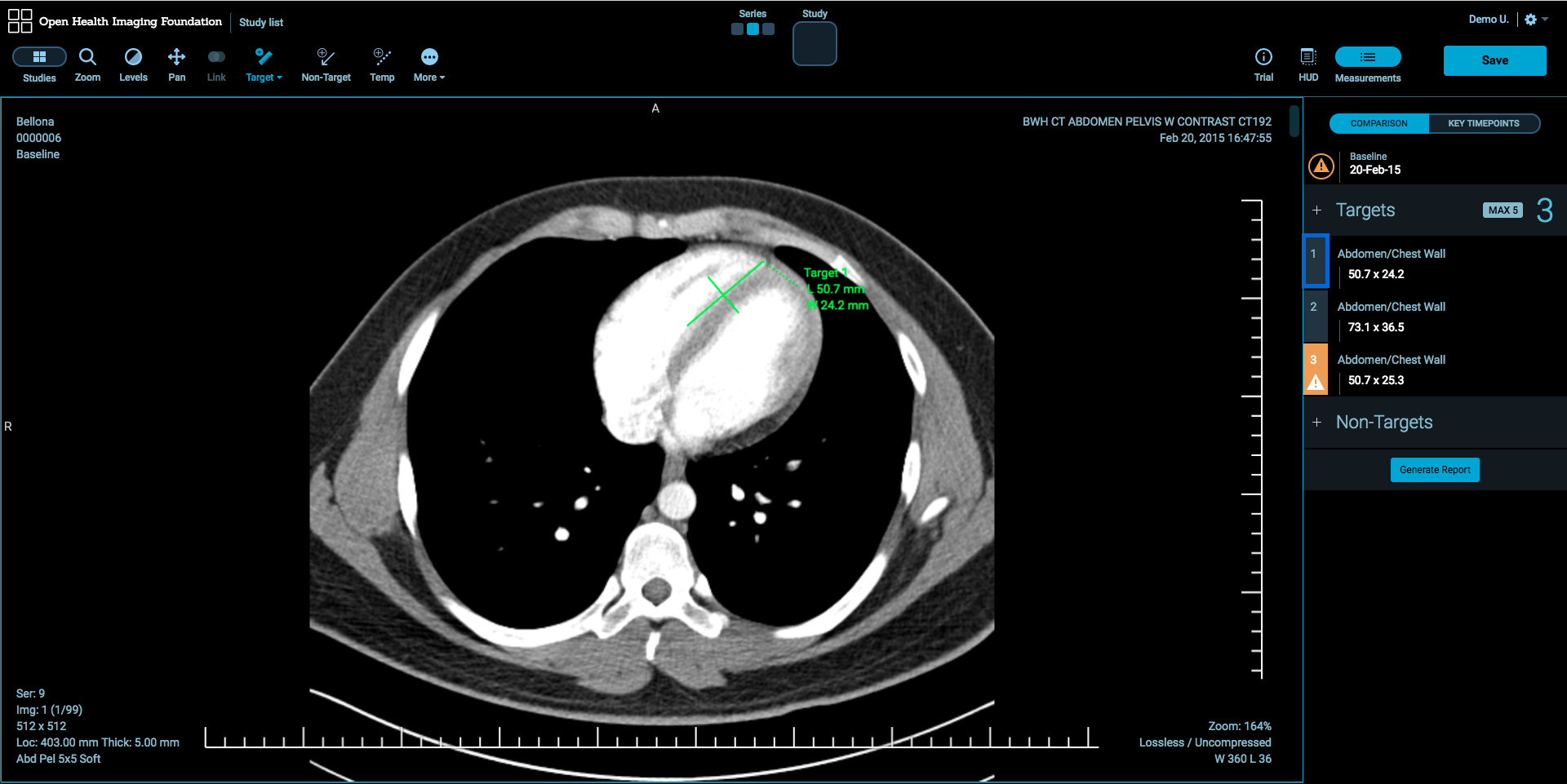 View Lesion